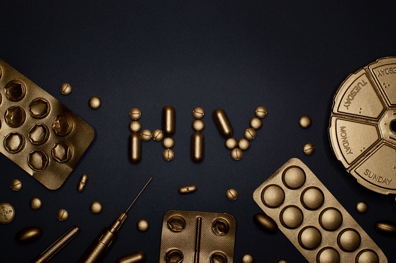 HIV 검사